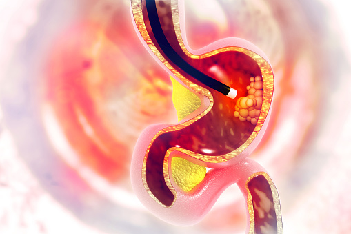 Rendering of endoscopy procedure